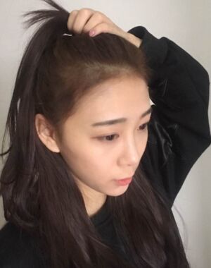 面部埋x后的恢复过程 快来看看我的果吧