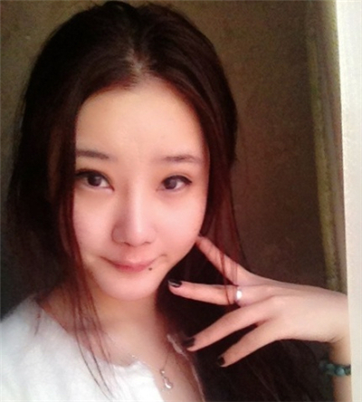 激光去雀斑+华尔兹冰点脱全身毛术后恢复过程照片分享~~