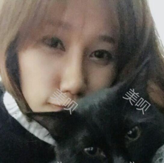 膨体隆鼻后我也有了像明星那样的小翘鼻了