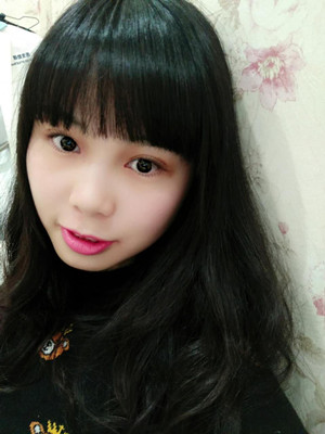 开内眼角+双眼皮手术后，我也变成大眼睛妹纸了