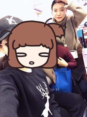 去年12月做的自体脂肪填充苹果肌，大家来看看果怎么样?