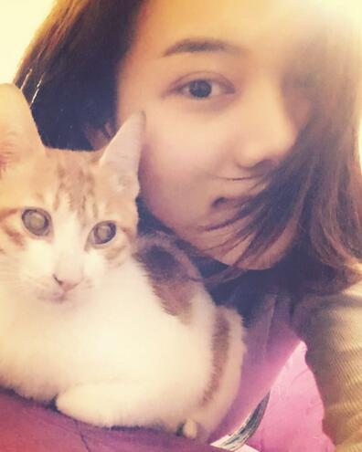 全切双眼皮恢复1个月过程图