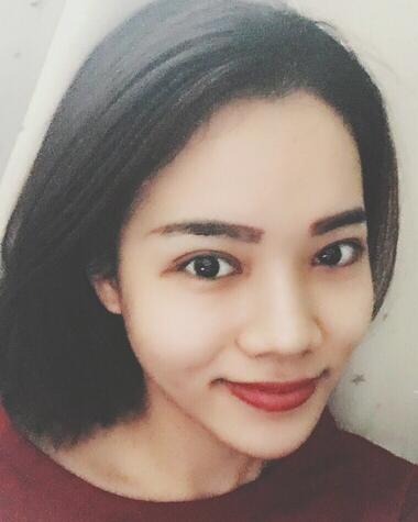 全切双眼皮恢复1个月过程图