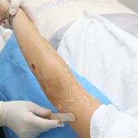 从小我就毛发旺盛，做了激光脱毛果图分享给大家