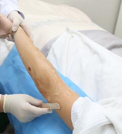 护士先剃除手臂多数体毛，还说我皮肤有些干燥