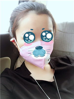 磨下颌角改脸型手术的变美历程