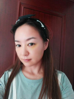 埋埋蛋白线.提升术之后气色都变好了哟