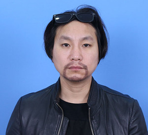 种植胡须手术前后过程以及对比照片分享