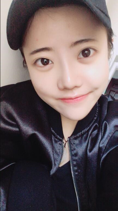 我的隆鼻整形恢复前后对果图 一个字帅