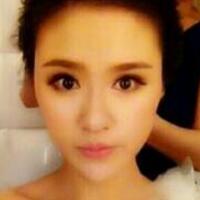 做了磨下颌角手术一年了，手术费用为16800元，已经完全恢复