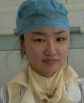 磨下颌骨术后第4天