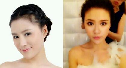 磨骨后下颌角恢复好后，觉得果很好，我又去做了鼻部整形，垫了下吧