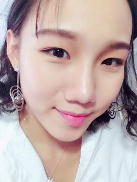 玻尿酸隆鼻术后2周鼻子算是完全恢复了