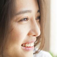 一横心做了割双眼皮+开眼角+隆鼻整形，真实经历分享