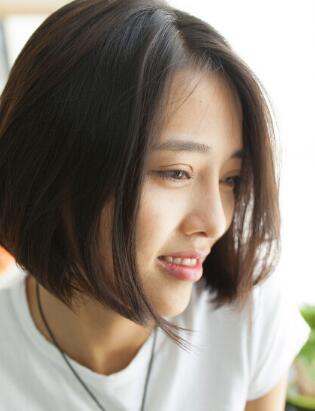 割双眼皮+开眼角+隆鼻整形