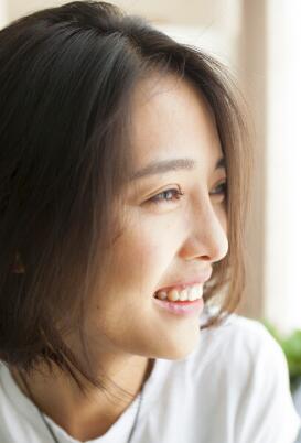 割双眼皮+开眼角+隆鼻整形