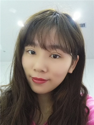 双眼皮多项整形前后大对比