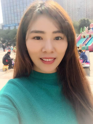 双眼皮多项整形前后大对比