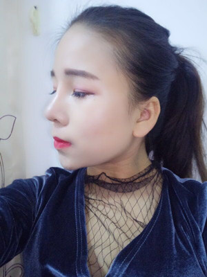 广州广美做的假体隆鼻，给大家分享一下手术前后过程以及对比照片