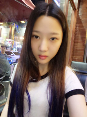 切开双眼皮+假体隆下巴，我不再是典型的路人甲