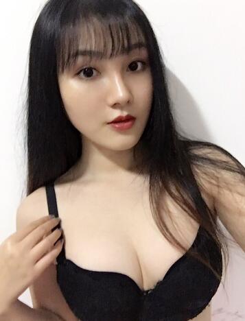 重庆好美自体脂肪隆胸已经一个月了