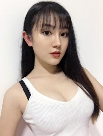 重庆好美自体脂肪隆胸已经一个月了