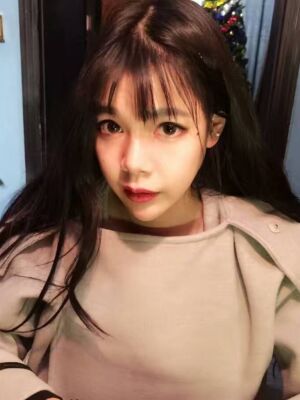 详细部自体脂肪填充基本恢复照片