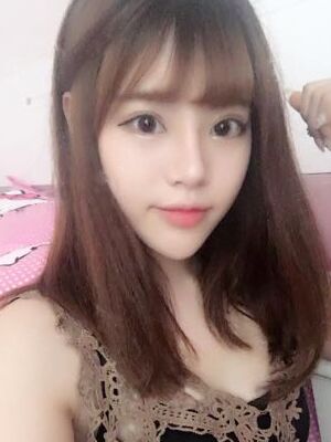 耳软骨垫鼻尖+硅胶假体隆鼻前后对比，变化是不是很大