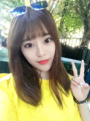 耳软骨垫鼻尖+硅胶假体隆鼻前后对比，变化是不是很大