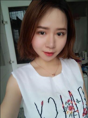 大鼻子就得做隆鼻整形手术改良 我的果就挺不错的