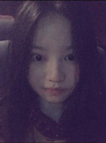 我的隆鼻整形恢复时的那些事