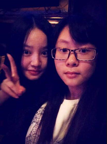 我的隆鼻整形恢复时的那些事