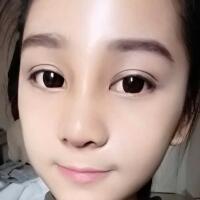 隆鼻整形恢复日记分享，整形价格8800元