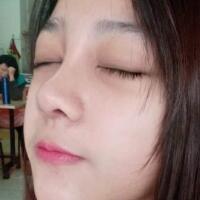 隆鼻整形恢复日记分享，整形价格8800元