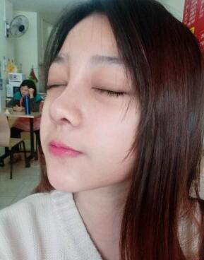 隆鼻整形恢复日记分享