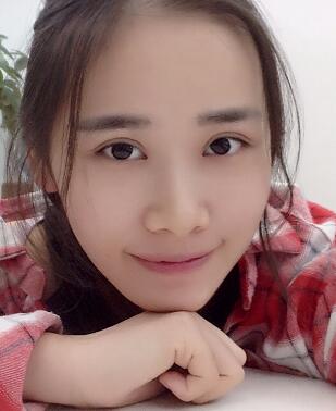 割双眼皮一个半月了，双眼皮完全恢复自然