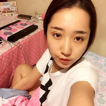 欧式大双眼皮的恢复过程分享哦