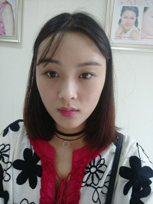 自体脂肪填充全脸，我也可以美美哒