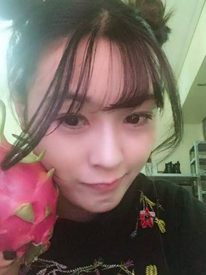 自体脂肪填充全脸，我也可以美美哒