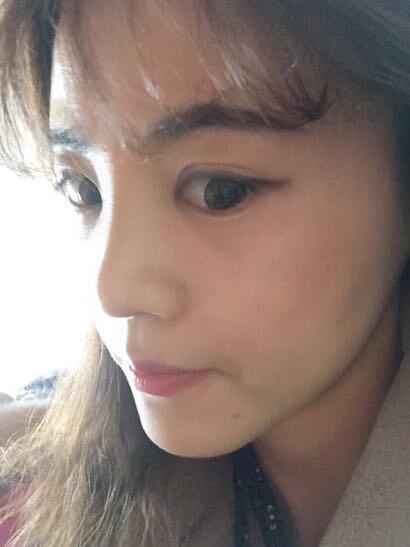 鼻子做完假体12天恢复图