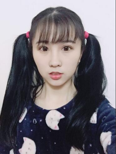 切的双眼皮90天恢复过程图