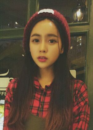 自体脂肪丰额头+苹果肌恢复两个月照片分享