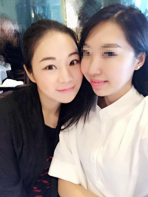 做完高强度聚焦超声之后都说我变漂亮了