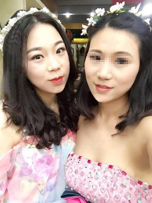 做完高强度聚焦超声之后都说我变漂亮了