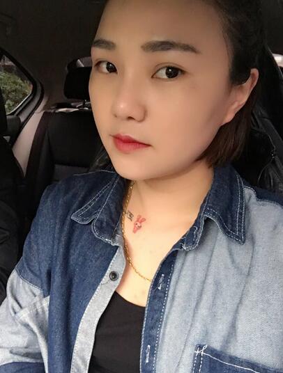 假体隆鼻+鼻翼缩小 前后对比照片