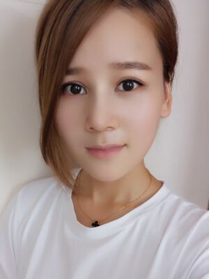 隆鼻和双眼皮修复一起做的，现在气质提升好多