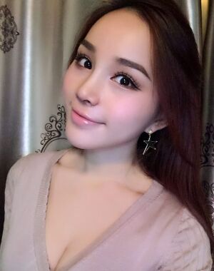 隆鼻整形+硅胶垫下巴前后对比照片给大家瞅瞅