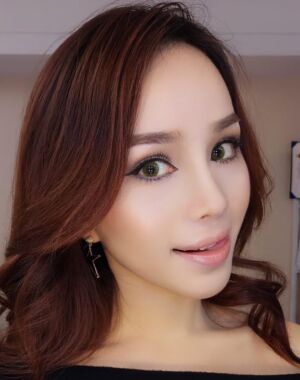 隆鼻整形+硅胶垫下巴前后对比照片给大家瞅瞅