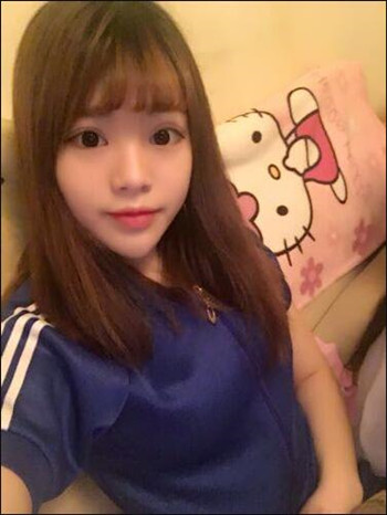 我的隆鼻整形恢复记录流水账