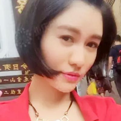 玻尿酸注射鼻子+下巴+太阳穴+苹果肌术后一个月的果照片~